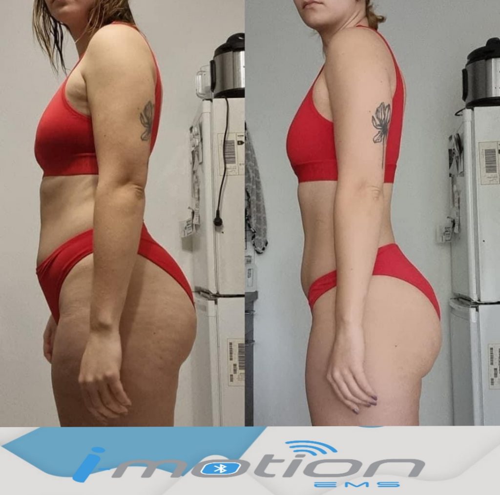 Avant/Après les séances d'électrostimulation I-Motion EMS FEMME