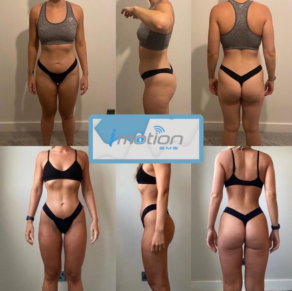 Avant/Après les séances d'électrostimulation I-Motion EMS femme tonique