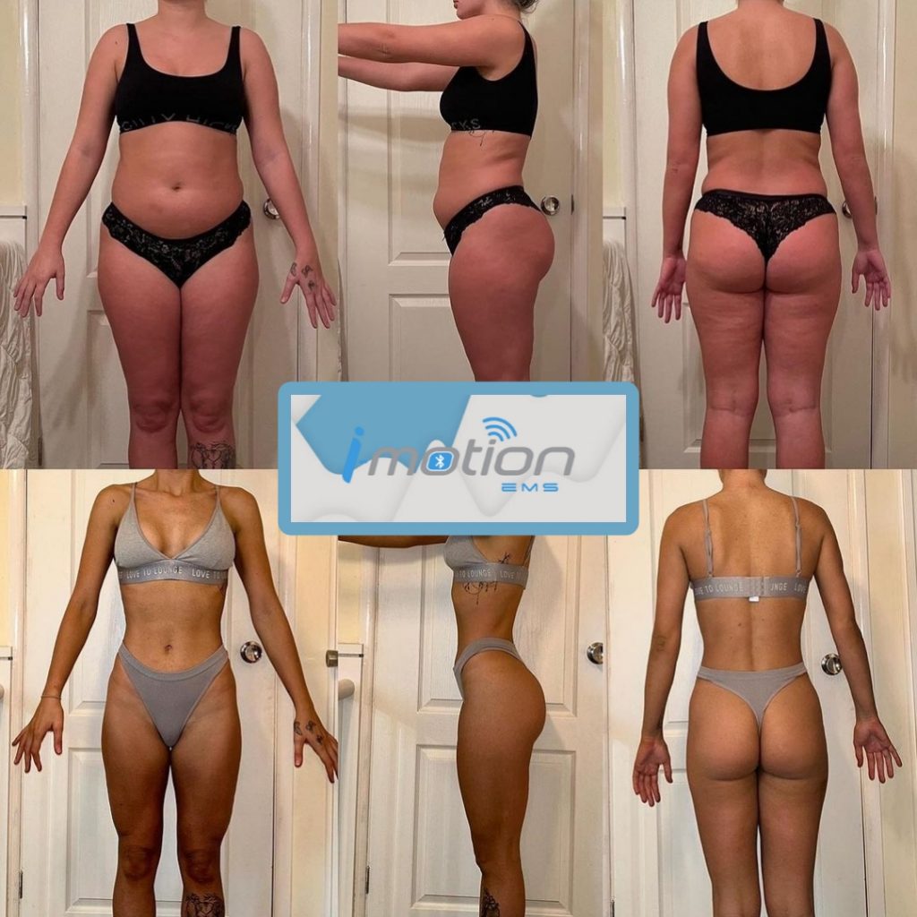 Avant/Après les séances d'électrostimulation I-Motion EMS FEMME FITNESS