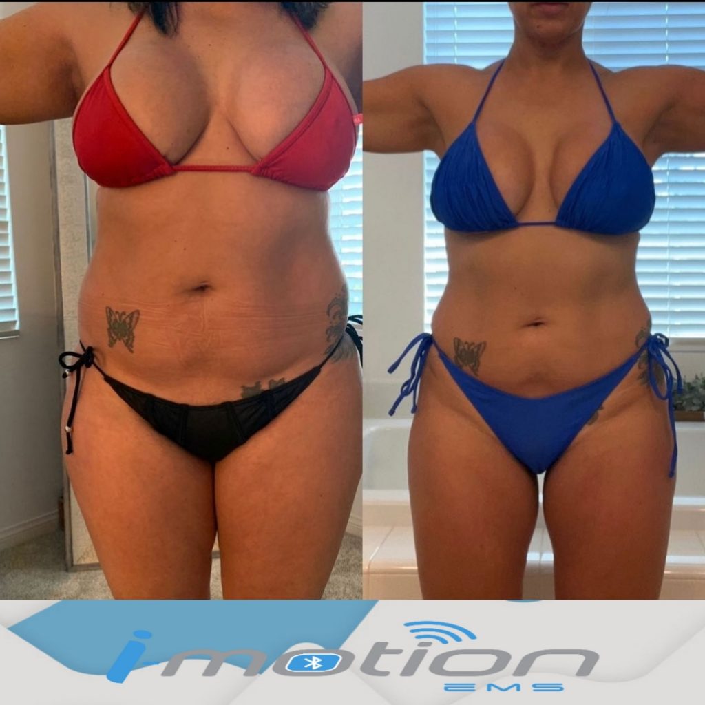 Avant/Après les séances d'électrostimulation I-Motion EMS femme ronde