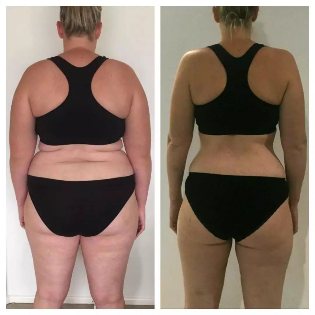 Avant après électrostimulation femme