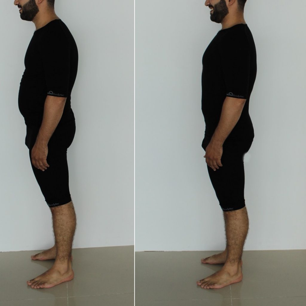 Avant/après electrostimulation homme